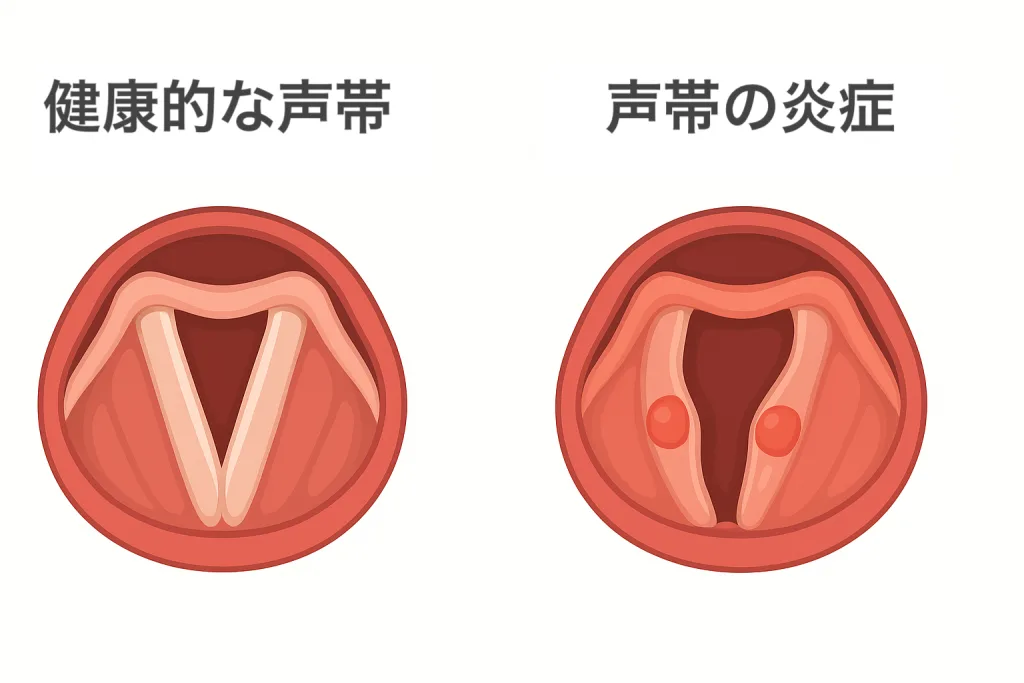 医学的観点からみた裏声の健康リスクと注意点